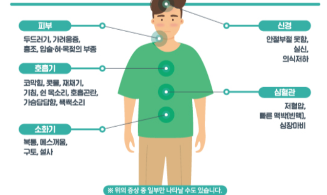 아나필락시스 증상