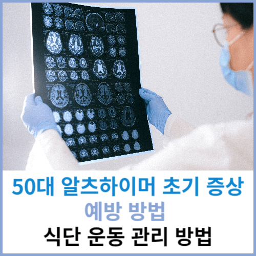 50대 알츠하이머 초기 증상 예방 방법 식단 운동 관리 방법